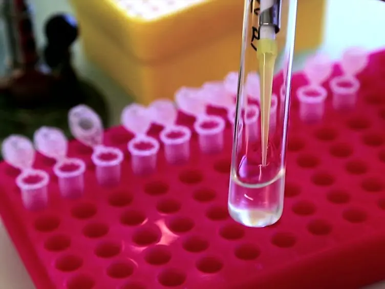 Temporal Quantification of MAPK Induced Expression in Single Yeast Cells