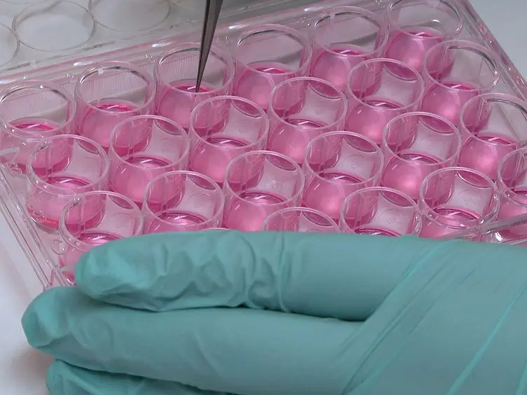 A Quantitative Cell Migration Assay for Murine Enteric Neural Progenitors