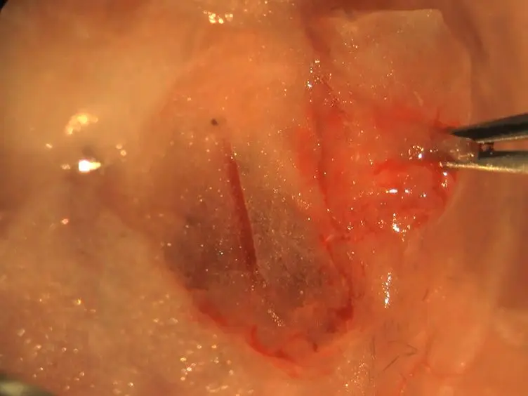 Isolation of Microvascular Endothelial Tubes from Mouse Resistance Arteries