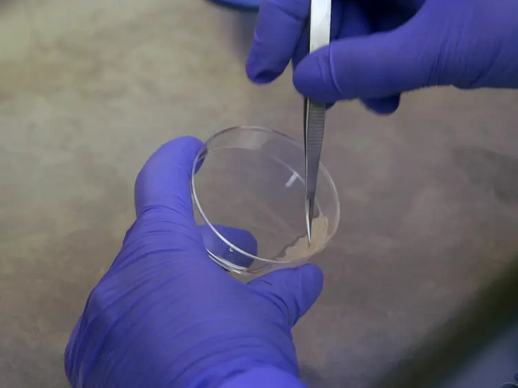 Calcium Phosphate Transfection of Primary Hippocampal Neurons