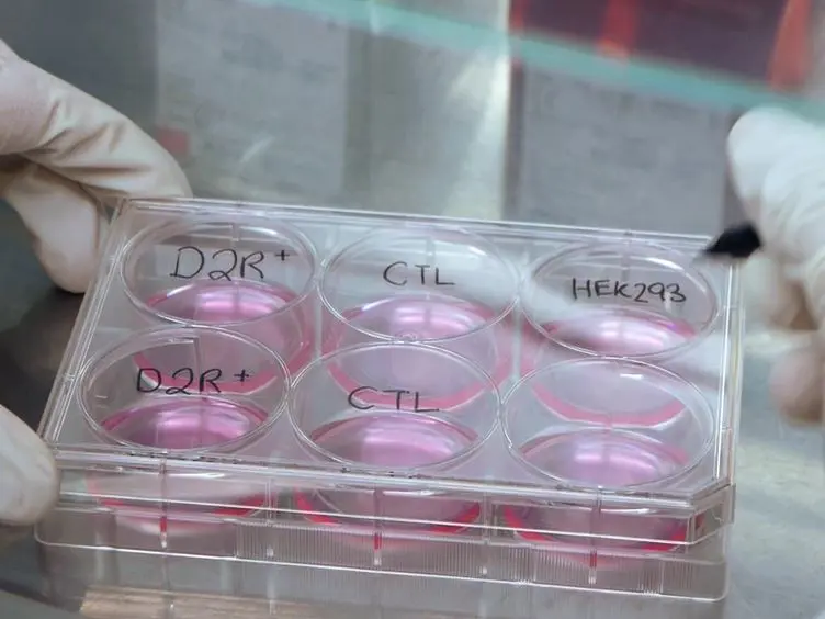 High-throughput Flow Cytometry Cell-based Assay to Detect Antibodies to N-Methyl-D-aspartate Receptor or Dopamine-2 Receptor in Human Serum