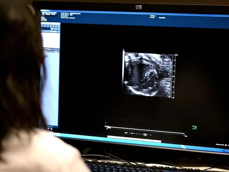 Assessment of Right Ventricular Structure and Function in Mouse Model of Pulmonary Artery Constriction by Transthoracic Echocardiography