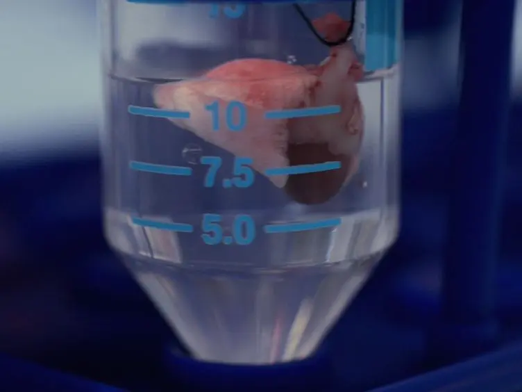 Cecal Ligation and Puncture-induced Sepsis as a Model To Study Autophagy in Mice