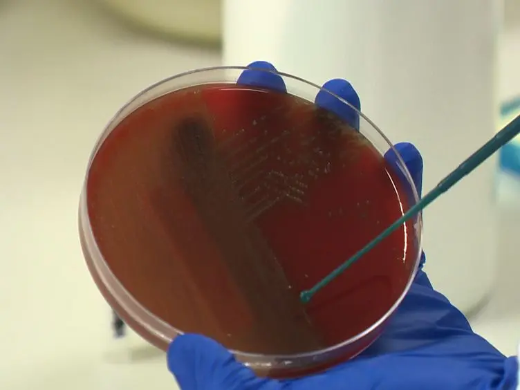 Capsular Serotyping of <em>Streptococcus pneumoniae</em> Using the Quellung Reaction