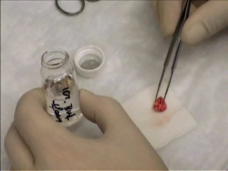 A Mouse Tumor Model of Surgical Stress to Explore the Mechanisms of Postoperative Immunosuppression and Evaluate Novel Perioperative Immunotherapies