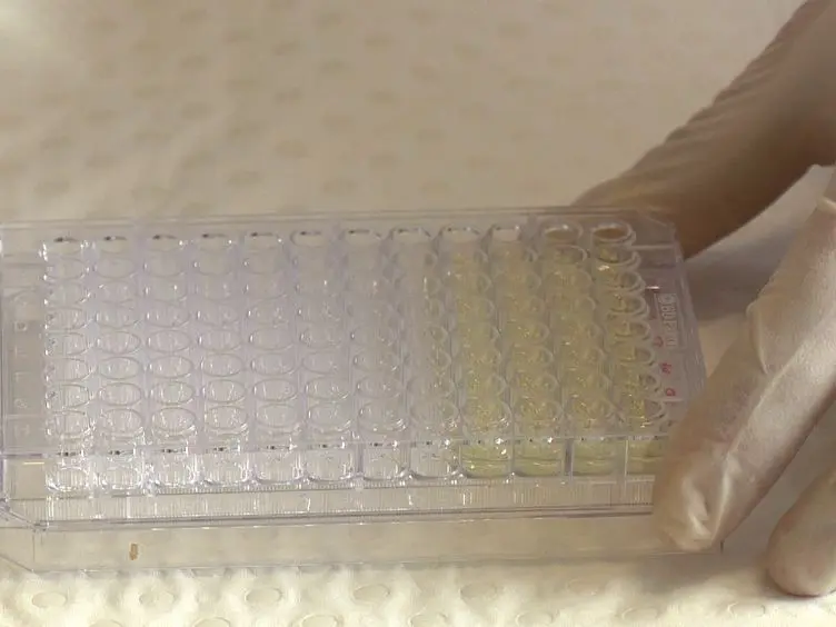 A Rapid and Specific Microplate Assay for the Determination of Intra- and Extracellular Ascorbate in Cultured Cells
