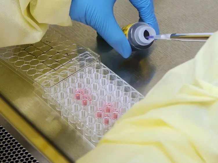 A Protocol for Analyzing Hepatitis C Virus Replication