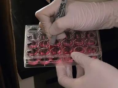Efficient Generation Human Induced Pluripotent Stem Cells from Human Somatic Cells with Sendai-virus