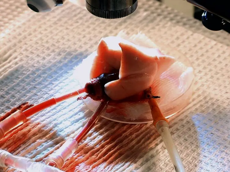 Quantifying Single Microvessel Permeability in Isolated Blood-perfused Rat Lung Preparation
