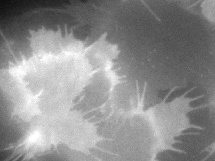 Visualizing Clathrin-mediated Endocytosis of G Protein-coupled Receptors at Single-event Resolution via TIRF Microscopy