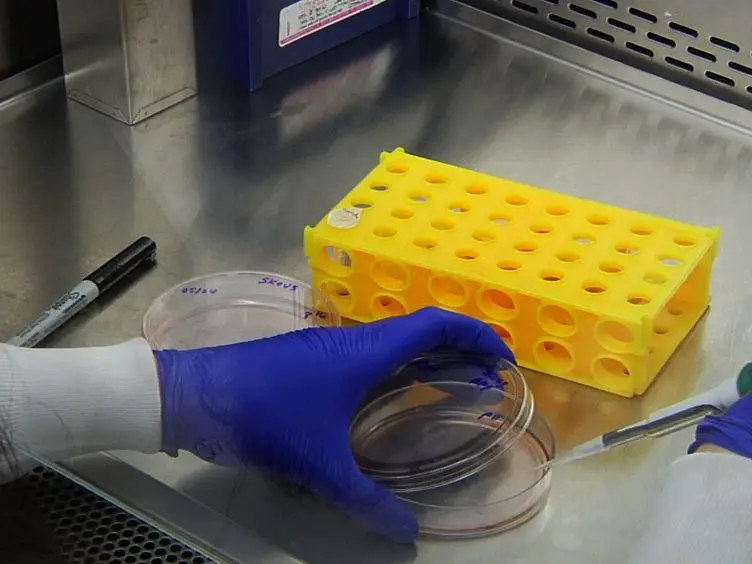 Enrichment for Chemoresistant Ovarian Cancer Stem Cells from Human Cell Lines