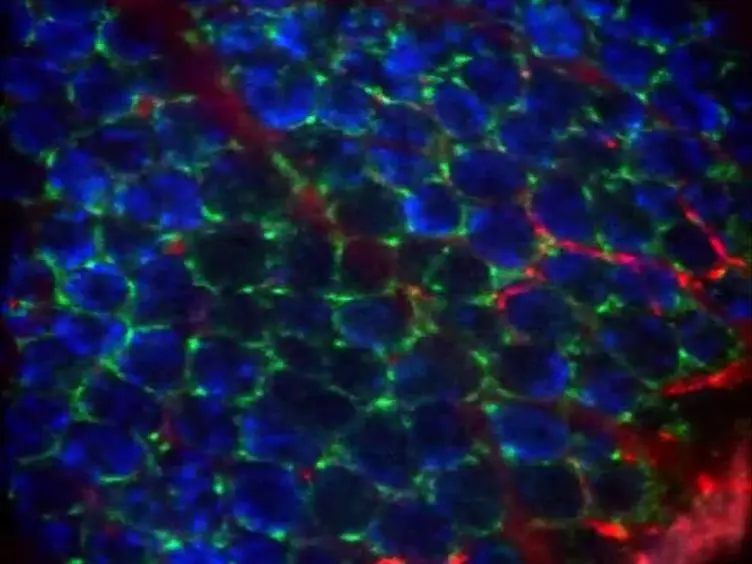 Real-time Imaging of Myeloid Cells Dynamics in <em>Apc<sup>Min/+</sup></em> Intestinal Tumors by Spinning Disk Confocal Microscopy