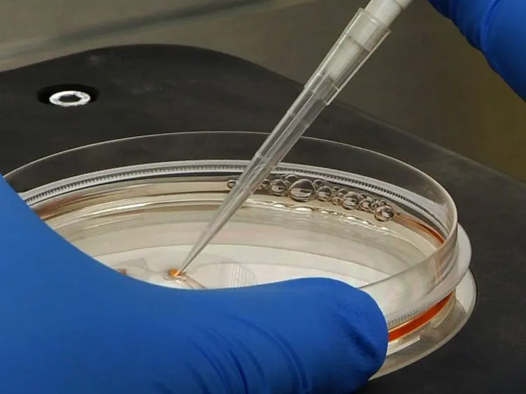 Generation of Induced Pluripotent Stem Cells from Muscular Dystrophy Patients: Efficient Integration-free Reprogramming of Urine Derived Cells