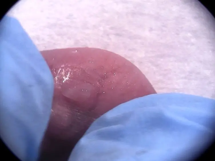 Intravenous Injections in Neonatal Mice