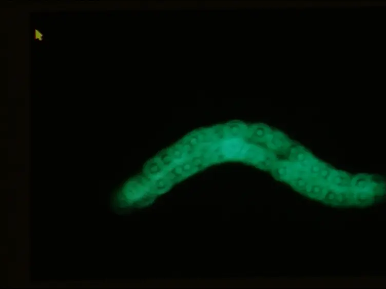 Methods to Assess Subcellular Compartments of Muscle in <em>C. elegans</em>