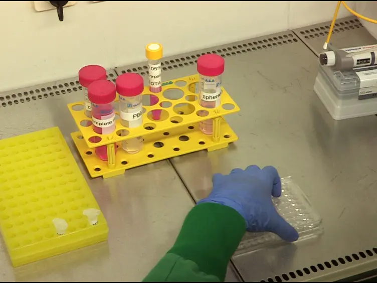 Evaluation of Stem Cell Properties in Human Ovarian Carcinoma Cells Using Multi and Single Cell-based Spheres Assays