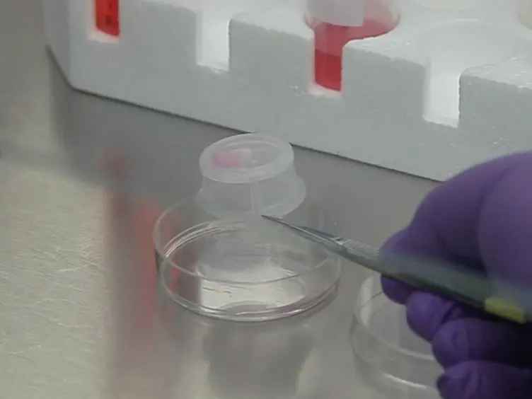 Deriving Retinal Pigment Epithelium (RPE) from Induced Pluripotent Stem (iPS) Cells by Different Sizes of Embryoid Bodies