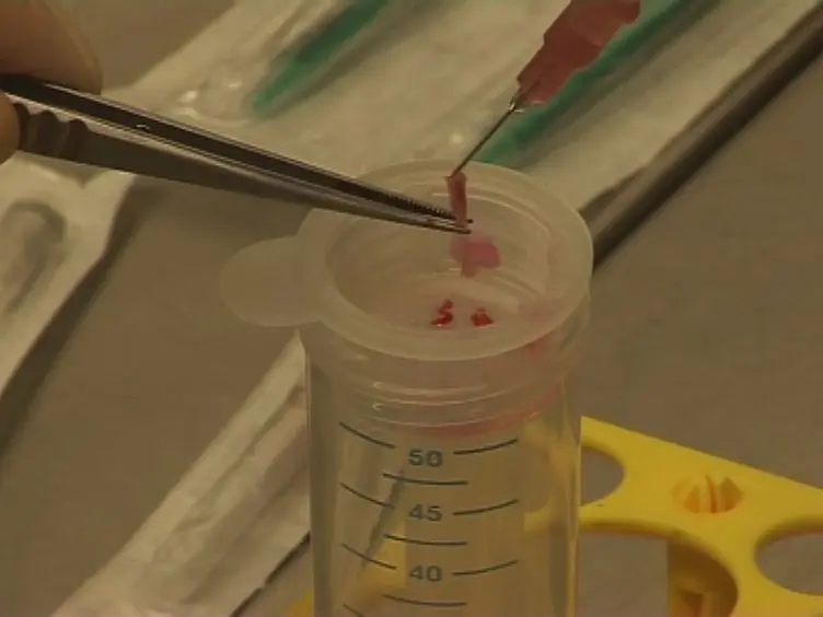Isolation and Intravenous Injection of Murine Bone Marrow Derived Monocytes