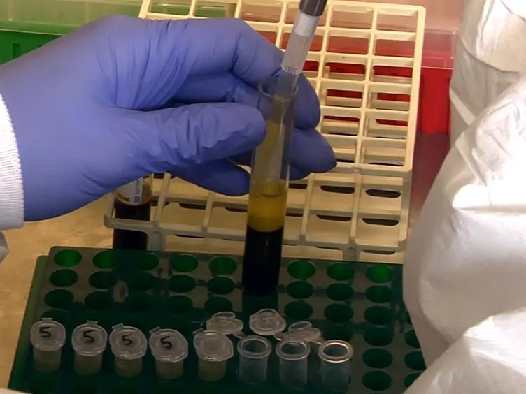 Techniques for the Analysis of Extracellular Vesicles Using Flow Cytometry