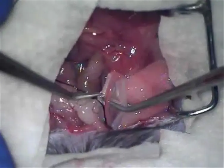 A Murine Model of Irreversible and Reversible Unilateral Ureteric Obstruction