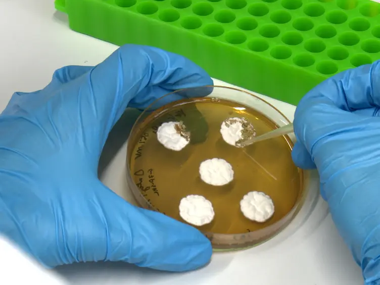 Analysis of Autophagy in <em>Penicillium chrysogenum</em> by Using Starvation Pads in Combination With Fluorescence Microscopy