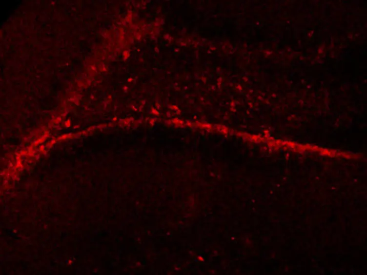 Applying Stereotactic Injection Technique to Study Genetic Effects on Animal Behaviors