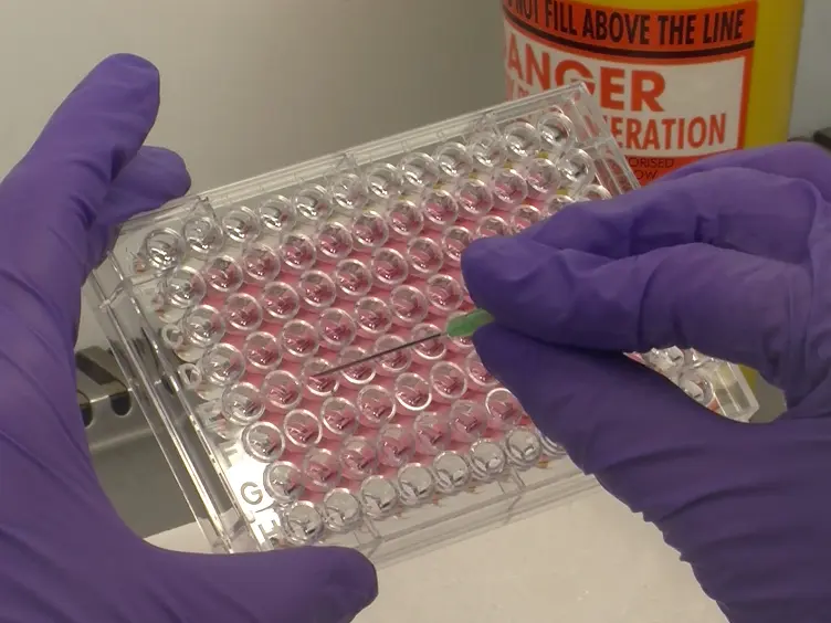 Three-Dimensional (3D) Tumor Spheroid Invasion Assay
