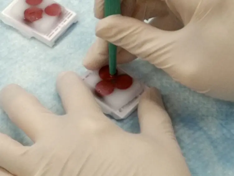 SpOT the Correct Tissue Every Time in Multi-tissue Blocks