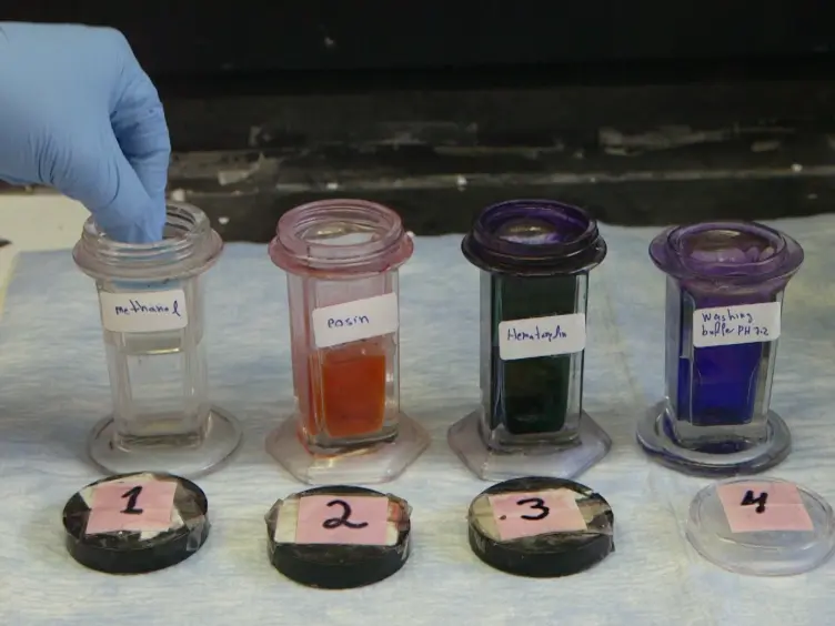 Isolation and Characterization of Neutrophils with Anti-Tumor Properties