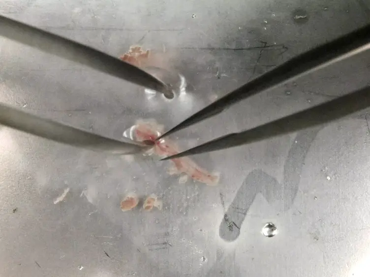 Isolation and Primary Culture of Mouse Aortic Endothelial Cells