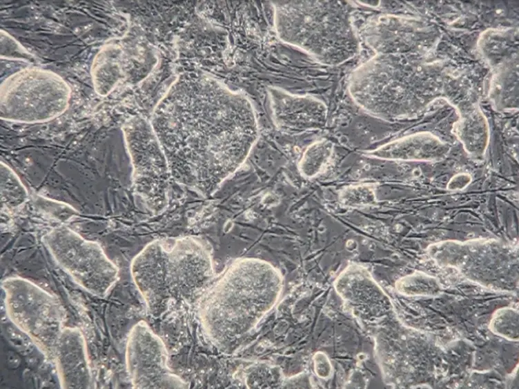 Forward Genetic Approach to Uncover Stress Resistance Genes in Mice &#8212; A High-throughput Screen in ES Cells