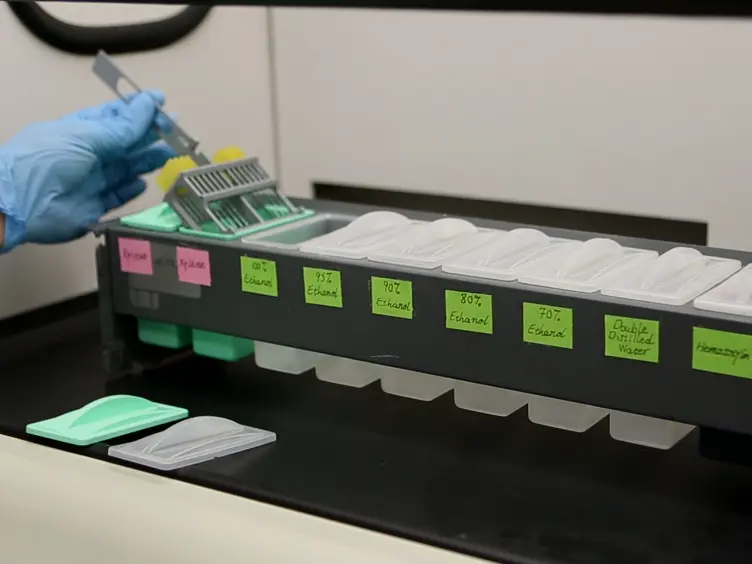 miRNA Expression Analyses in Prostate Cancer Clinical Tissues