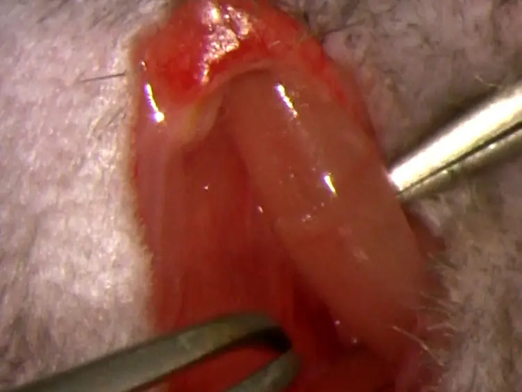 A Novel Murine Model of Arteriovenous Fistula Failure: The Surgical Procedure in Detail