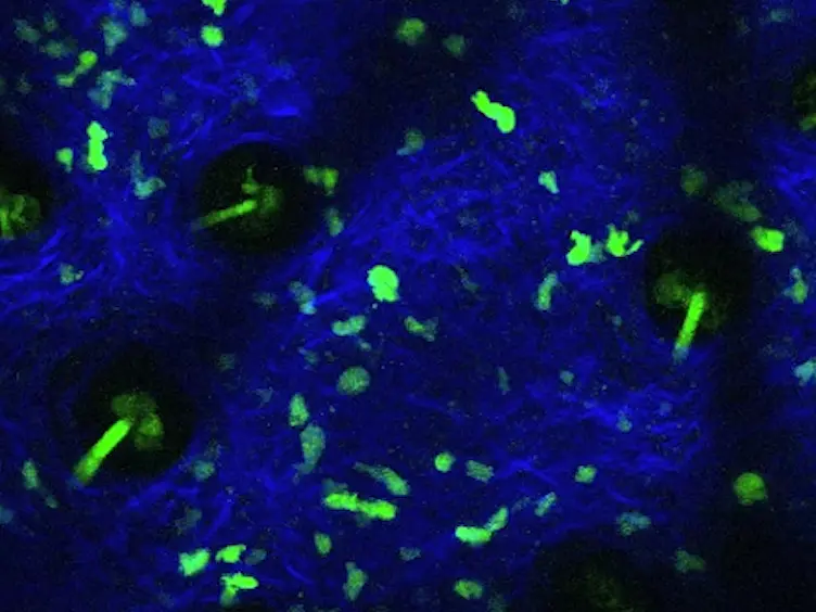 Imaging CD4 T Cell Interstitial Migration in the Inflamed Dermis