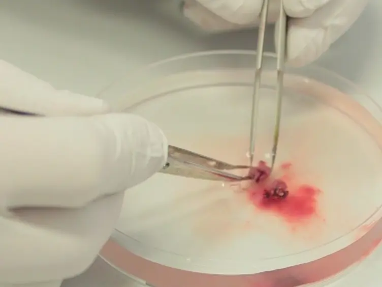 Simultaneous Assessment of Cardiomyocyte DNA Synthesis and Ploidy: A Method to Assist Quantification of Cardiomyocyte Regeneration and Turnover