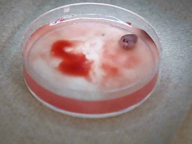 Isolation of Mouse Coronary Endothelial Cells