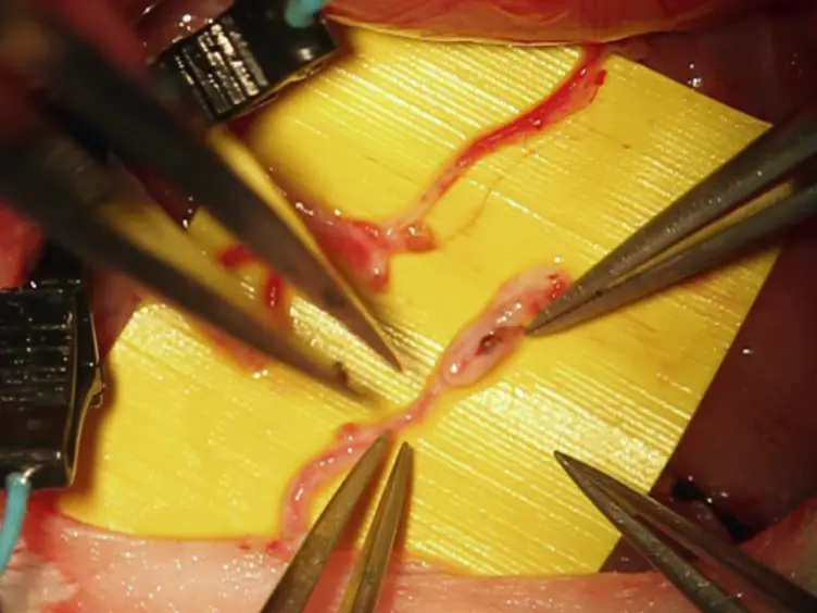 Tissue Engineering by Intrinsic Vascularization in an <em>In Vivo</em> Tissue Engineering Chamber