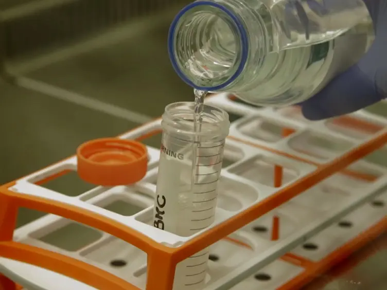 HPLC-based Assay to Monitor Extracellular Nucleotide/Nucleoside Metabolism in Human Chronic Lymphocytic Leukemia Cells