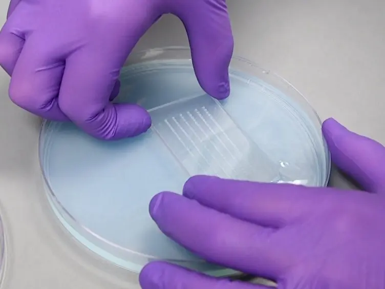 Nephrotoxin Microinjection in Zebrafish to Model Acute Kidney Injury