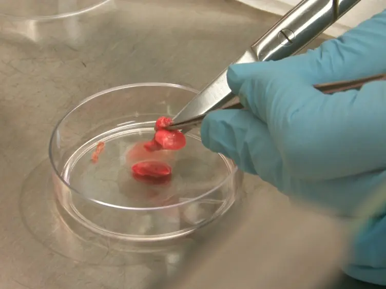 Studying the Role of Alveolar Macrophages in Breast Cancer Metastasis