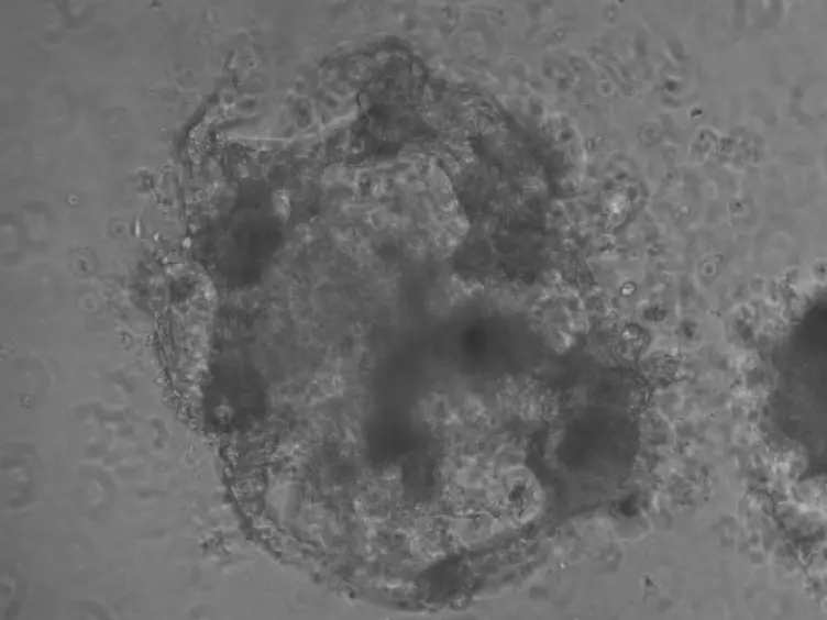 Aggregate Size Optimization in Microwells for Suspension-based Cardiac Differentiation of Human Pluripotent Stem Cells