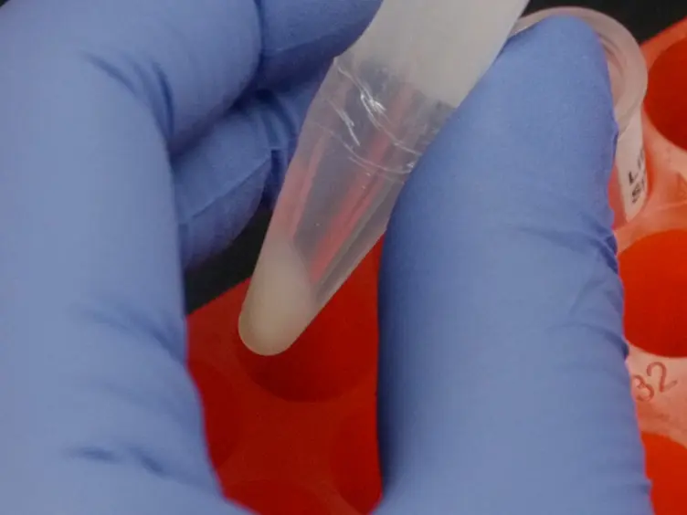 Bacterial Inner-membrane Display for Screening a Library of Antibody Fragments