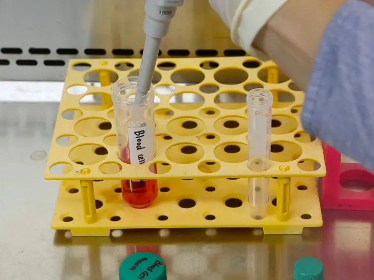 Induced Pluripotent Stem Cell Generation from Blood Cells Using Sendai Virus and Centrifugation
