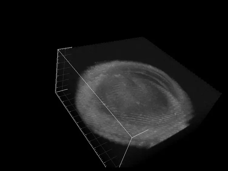 An Alternative and Validated Injection Method for Accessing the Subretinal Space <i>via</i> a Transcleral Posterior Approach