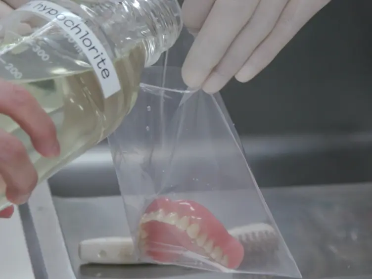 2-Methacryloyloxyethyl Phosphorylcholine Polymer Treatment of Complete Dentures to Inhibit Denture Plaque Deposition