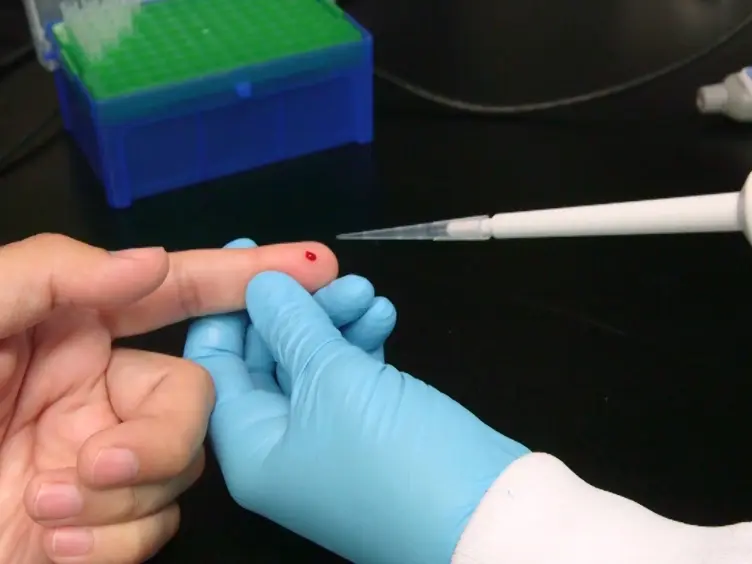 Magnetic Levitation Coupled with Portable Imaging and Analysis for Disease Diagnostics