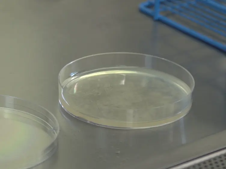 Use of the Soft-agar Overlay Technique to Screen for Bacterially Produced Inhibitory Compounds