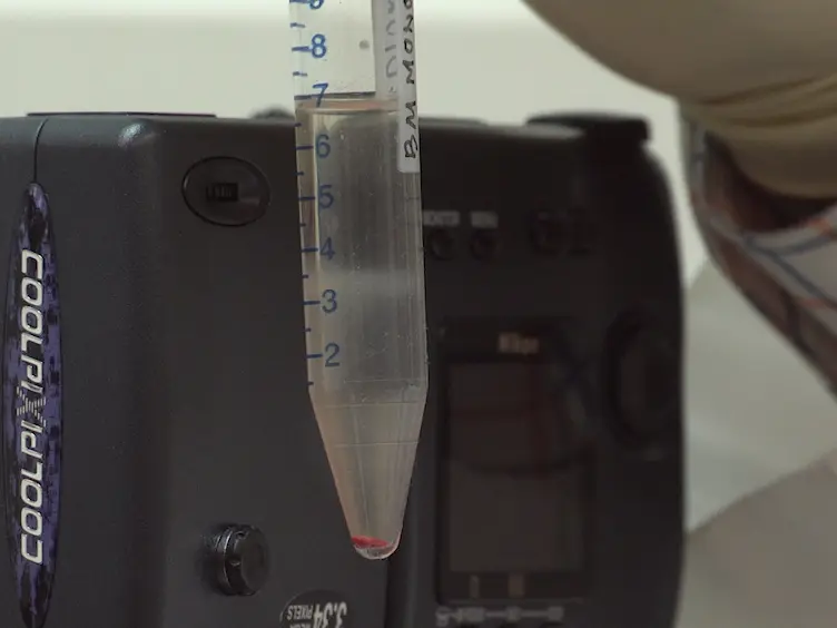 Detection of Inter-chromosomal Stable Aberrations by Multiple Fluorescence <em>In Situ</em> Hybridization (mFISH) and Spectral Karyotyping (SKY) in Irradiated Mice