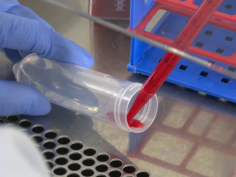 Isolation of Endothelial Progenitor Cells from Healthy Volunteers and Their Migratory Potential Influenced by Serum Samples After Cardiac Surgery