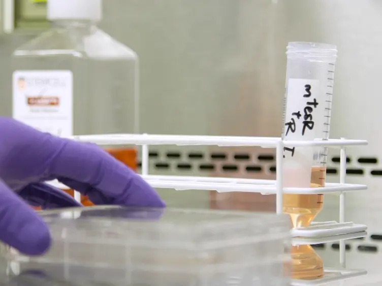 Defined and Scalable Generation of Hepatocyte-like Cells from Human Pluripotent Stem Cells